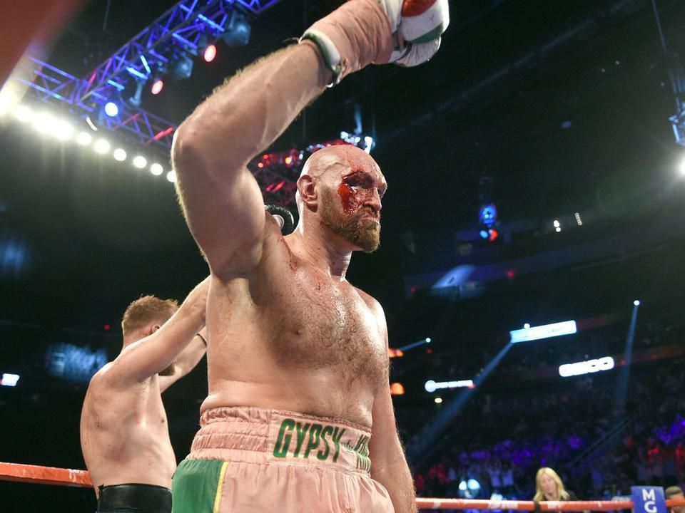 Tyson Fury csúnya sérülést szenvedett, de harcolt – egyhangú pontozással nyert (Fotó: Getty Images)