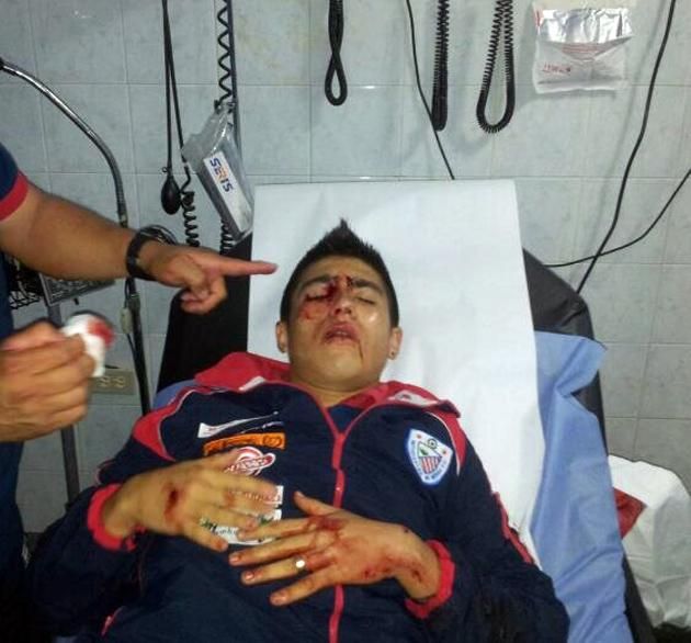 Jesus Quintero a támadás után, a műtét előtt (Fotó: Estudiantes de Merida)
