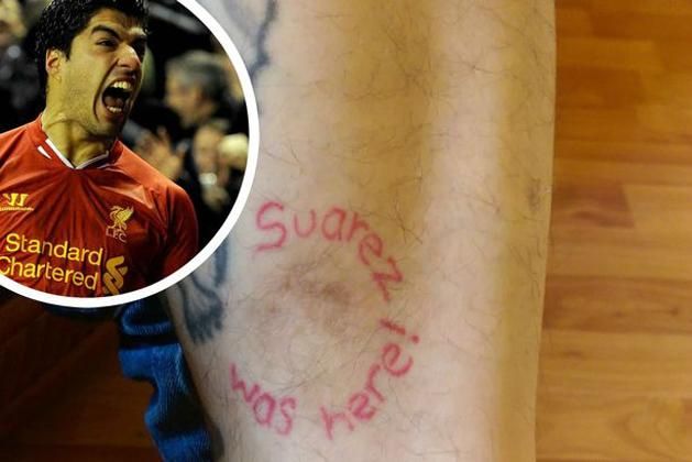 Megharapták egy kocsmai bunyóban, Suárez-tetkó lett belőle (Fotó: Liverpool Echo)