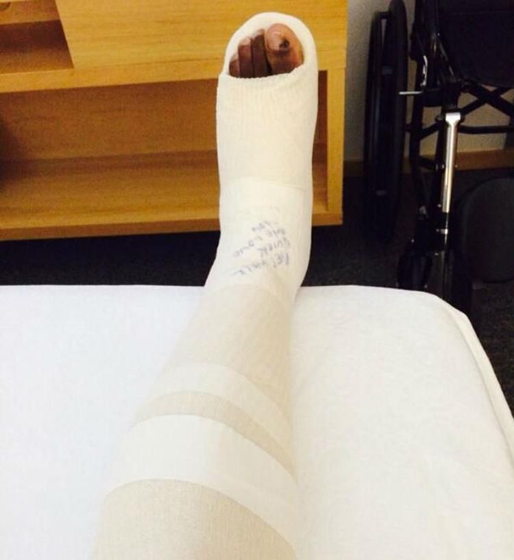 Onazi a Twitteren osztott meg képet a sérült bokájáról
