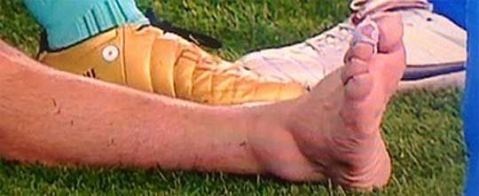 A sérült boka: ez sokáig fáj majd (Fotó: sport.es)