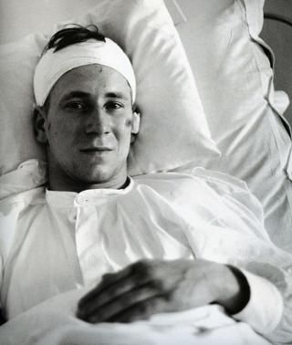Bobby Charlton a baleset után (Fotó: Pinterest)