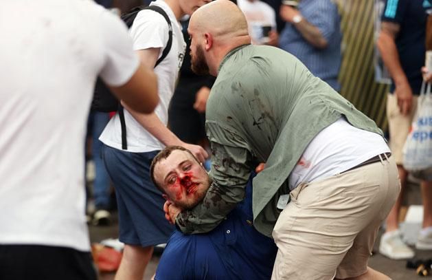 A shocking image of many: a fan beat to a pulp at Wembley