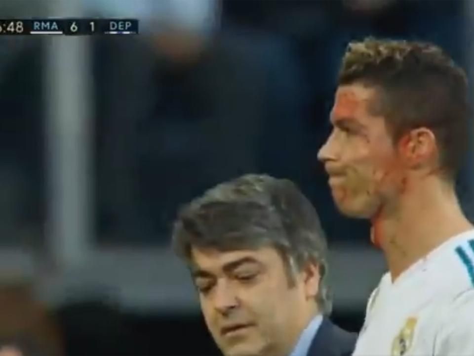 Ronaldo bosszúsan vette tudomásul a történteket (Fotó: Twitter)