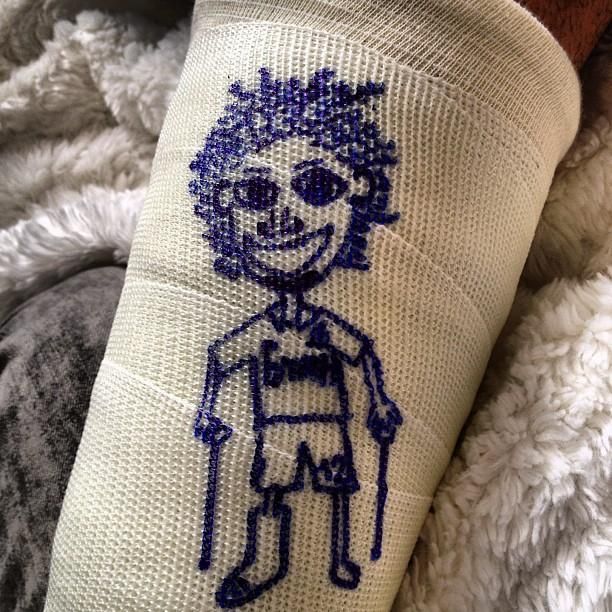 Marcelo, a kis bice-bóca (forrás: globo.com)