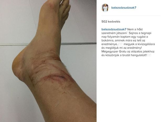 Így néz ki Dzsudzsák Balázs lába a horvátok elleni meccs után (Fotó: instagram.com/balazsdzsudzsak7)