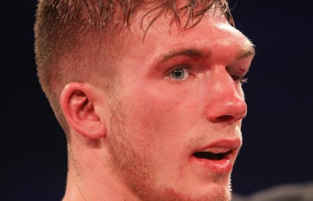 Így nézett ki Nick Blackwell szeme a mérkőzés végén (Fotó: theguardian.com)